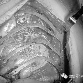 肿瘤切除后，数字材料与缺损完美契合
