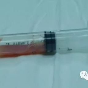 术中从脓肿抽出的脓液