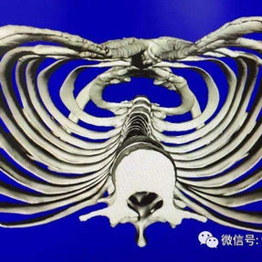 三维重建