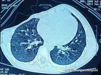 术前影像学检查