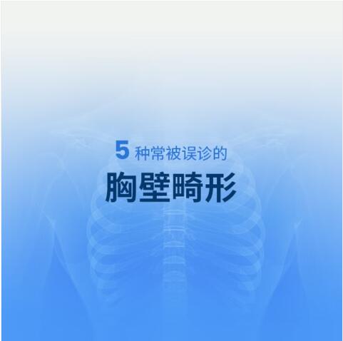 五种常被误诊的胸壁畸形