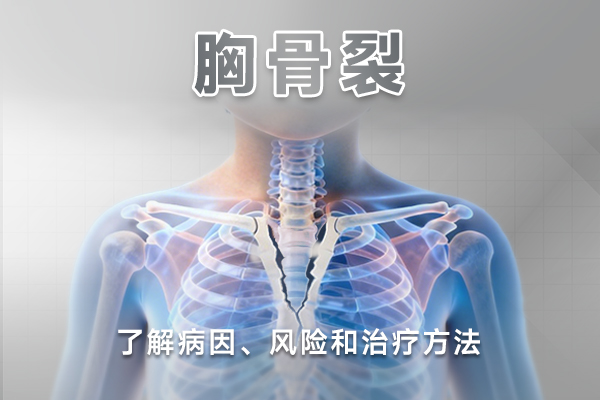 胸骨裂：了解病因、风险和治疗方法