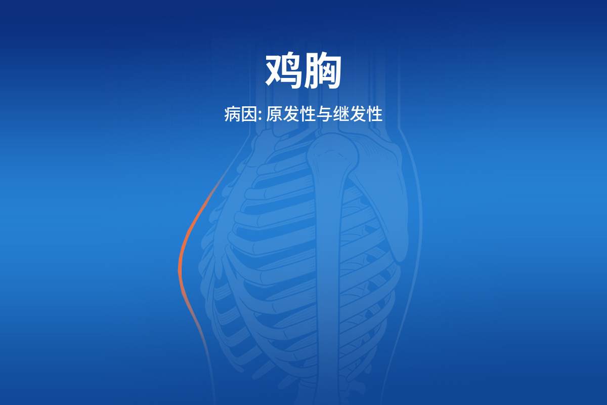 了解鸡胸的成因：原发性与继发性